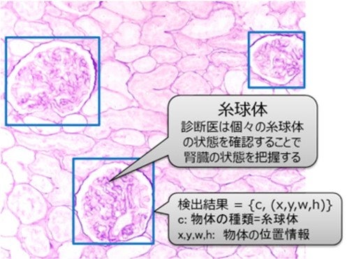 腎生検画像と糸球体検出