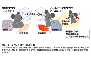 順天堂大、生活習慣病の発症機序に迫る新たな代謝制御メカニズムを解明