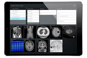 東大病院、CTやMRIの画像を誰でも簡単に見られるアプリを無料リリース