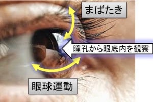 奈良先端大、眼底網膜像を「自撮り」できる小型眼底カメラシステム開発