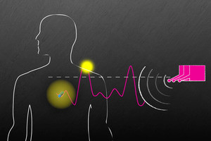 体内に埋め込んだデバイスに無線給電する技術を開発 - MIT