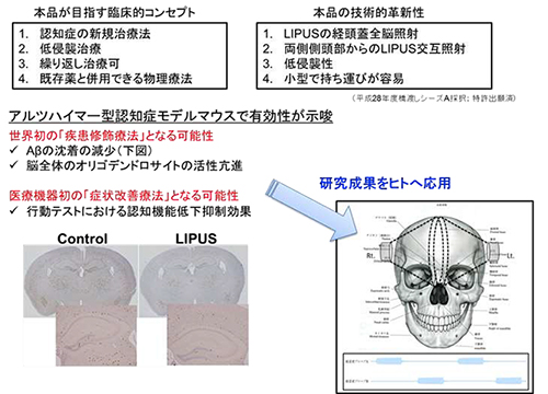 アルツハイマー型認知症を対象とした経頭蓋超音波治療装置の開発コンセプト(出所:東北大学ニュースリリース)