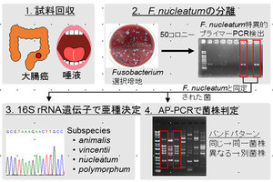 歯周病菌が大腸がんに関与している可能性 - 協同乳業