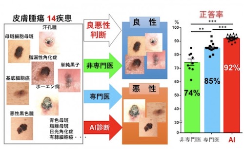 AI診断補助システムと皮膚科専門医の皮膚腫瘍の良悪性識別率の比較(出所:京セラニュースリリース)