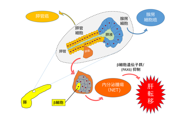 膵発がんの概念と、同研究で明らかになったNET肝転移のメカニズム