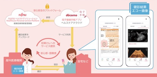 「妊婦健診 結果参照サービス」の仕組み