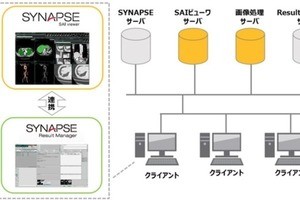 富士フイルム、画像診断ワークフローを支援するAIプラットフォームを開発