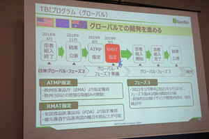 サンバイオの外傷性脳損傷向け再生細胞薬「SB623」がFDAのRMATに指定