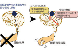 脳損傷後、機能回復を目指した新たな神経路が形成される - 産総研らが発見