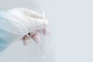 島津製作所、新型コロナウイルスの遺伝子検出試薬キットの開発を開始