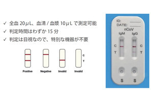 TKResearch、イムノクロマト法の新型コロナウイルス向け研究用試薬を発売