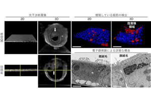 東大生研、3次元構造を持った「3D腸チップ」の開発に成功