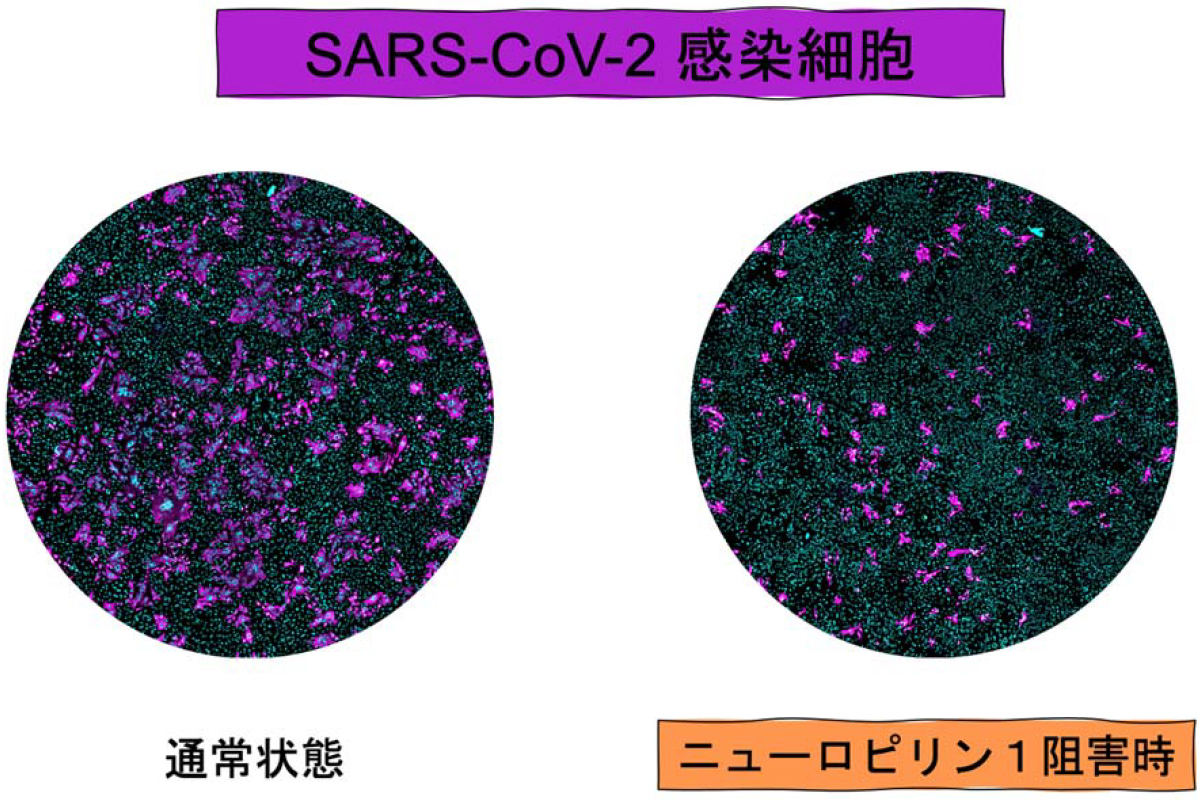 新型コロナウイルス