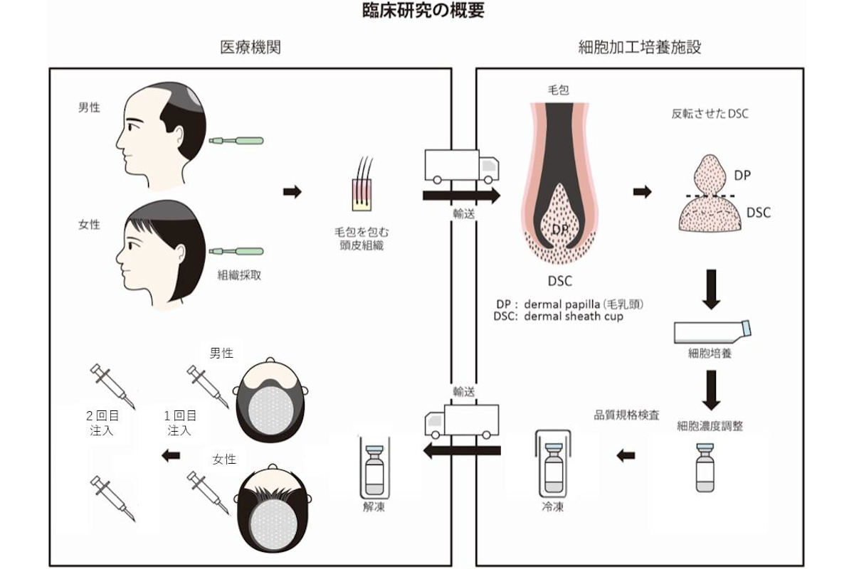 自家毛髪培養細胞