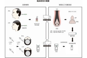 壮年性脱毛症のための再生医療の臨床試験を東京医科大などが実施