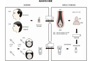 壮年性脱毛症のための再生医療の臨床試験を東京医科大などが実施