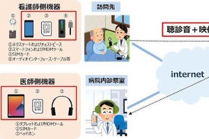 心音や呼吸音をリモート伝達 - NTTスマートコネクトがオンライン診療向けサービス