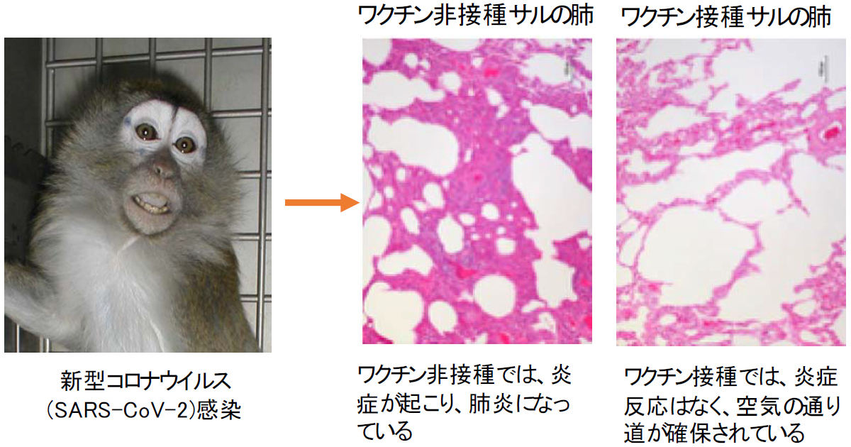 新型コロナワクチン