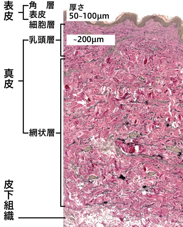 皮膚内の組織層