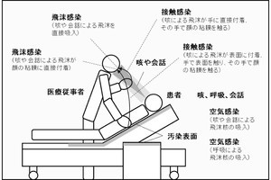 医療現場でもマスクなどで確実に感染リスクを下げられる - 近大が算出