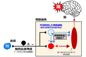 九大など、触覚が痛覚と混信して脳に届かないようにする抑制性神経を特定