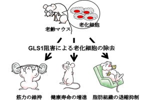 老化の抑制や改善に酵素「GLS1」の阻害が有効であることを東大医科研が確認