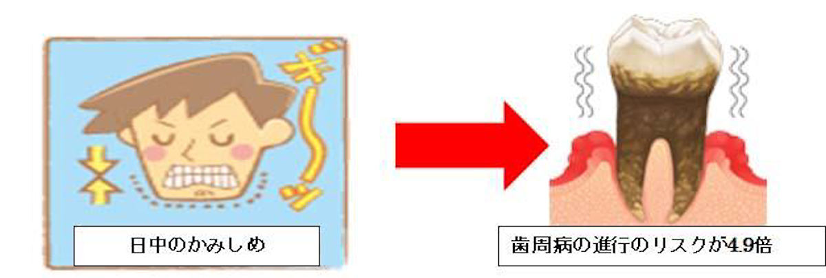 歯周病