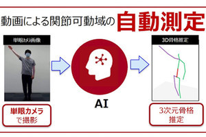 富士通、AIが患者のリハビリ動画から肩と肘の関節可動域を自動測定する製品