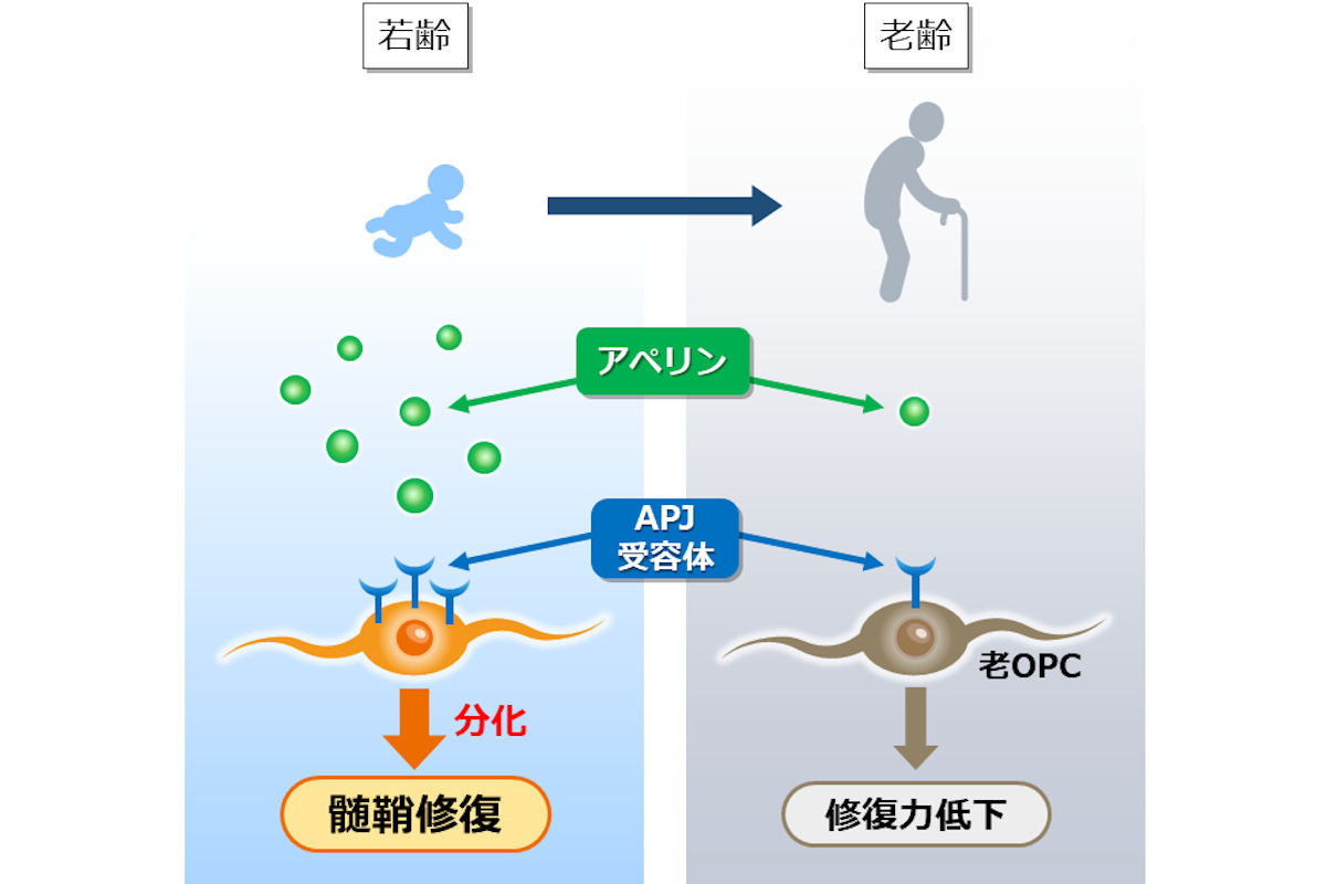 脳の老化