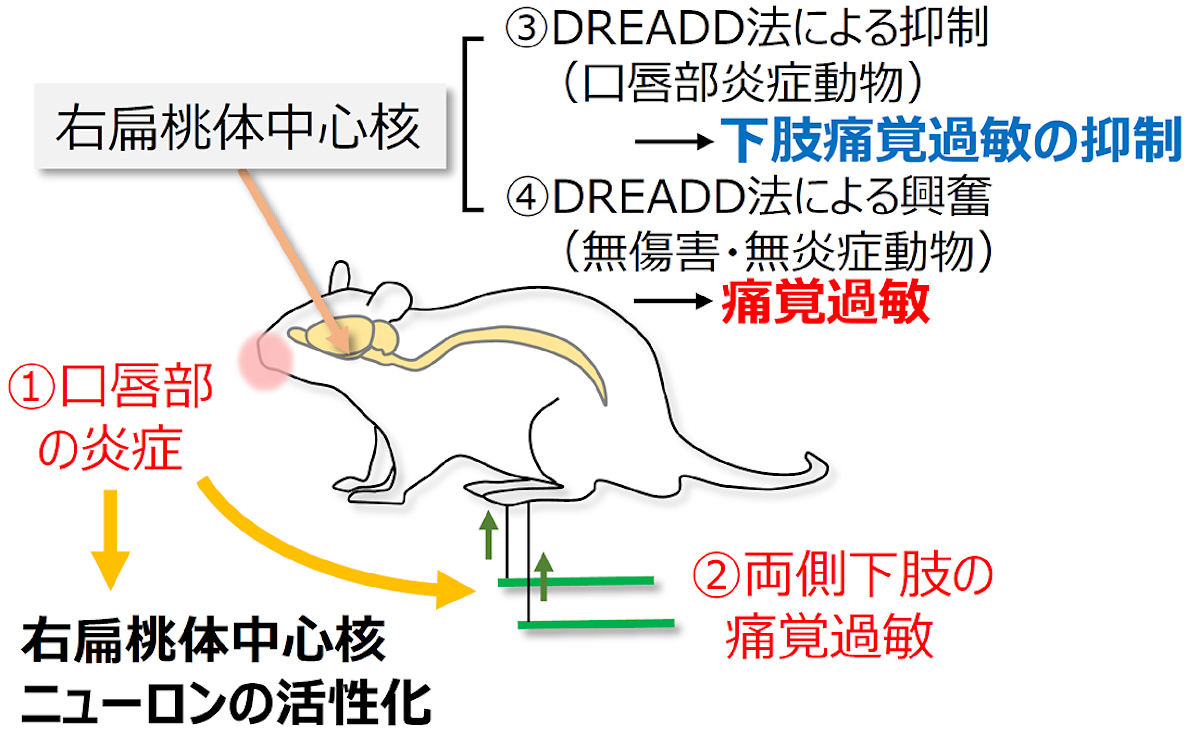 慢性疼痛