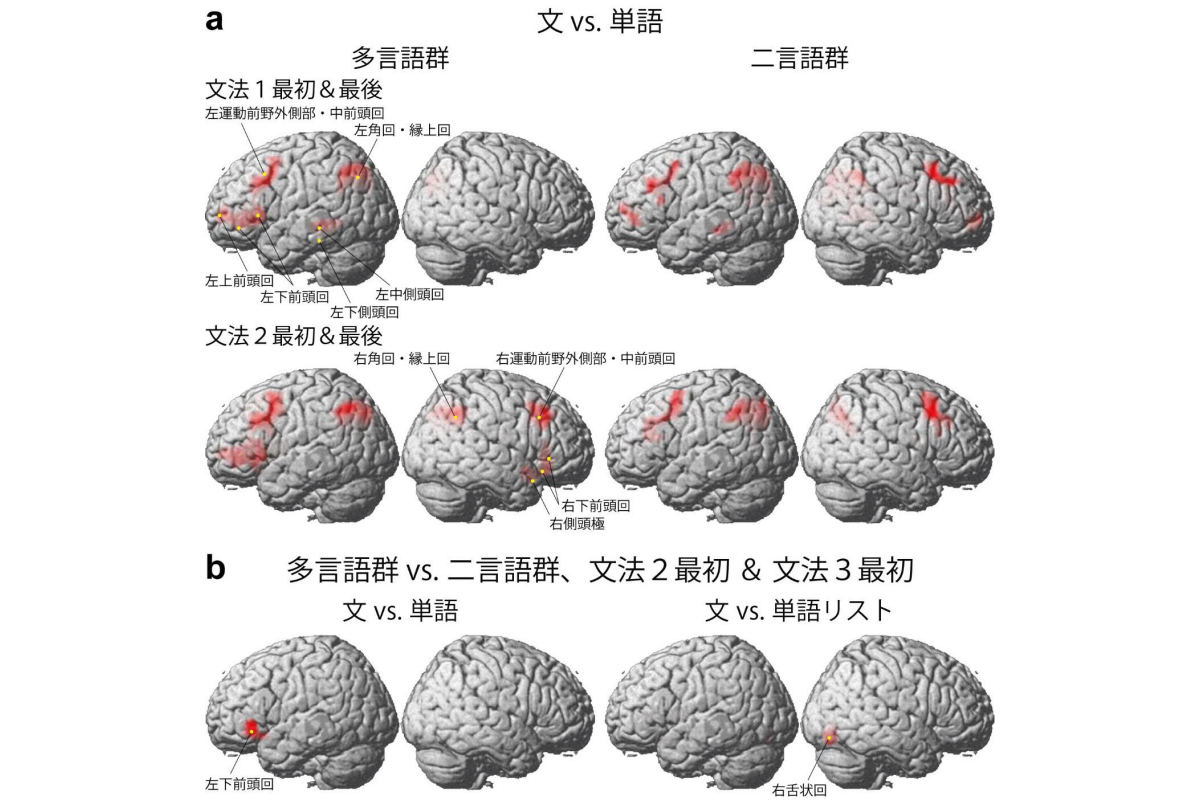 言語の脳活動