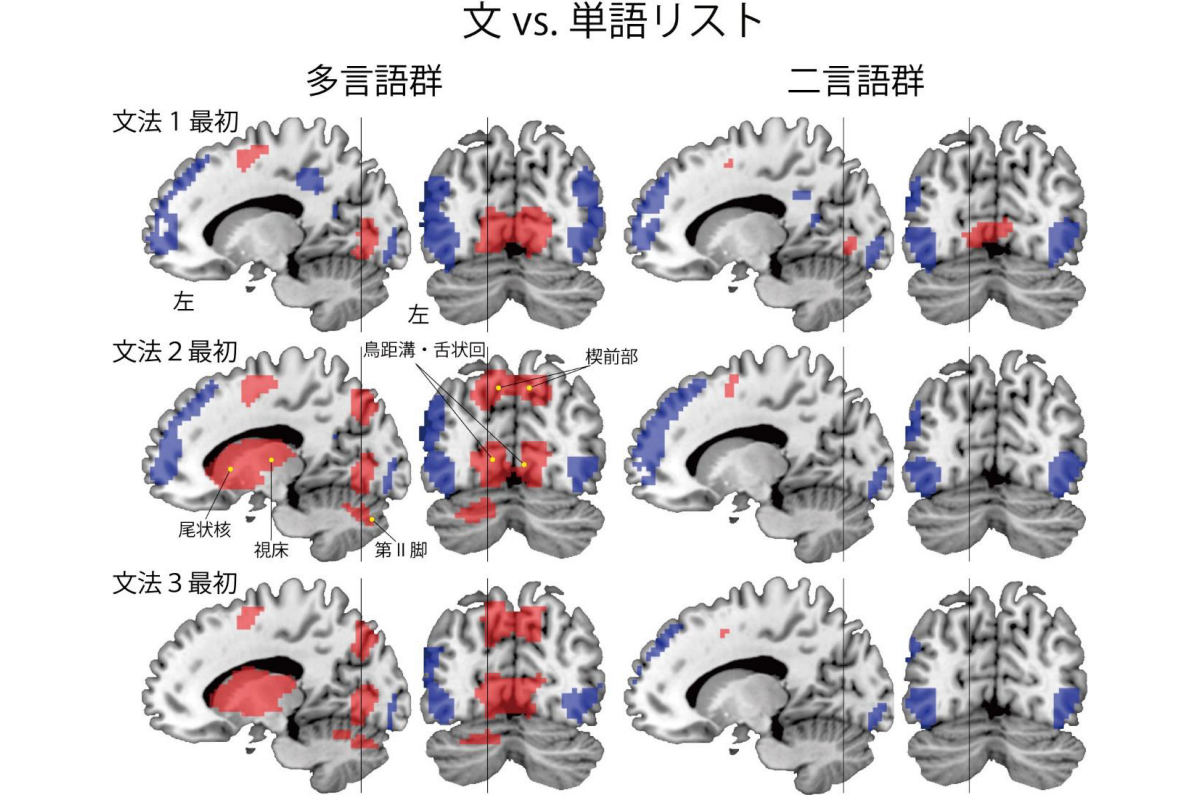 言語の脳活動