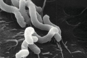 ピロリ菌が胃に感染し続ける仕組みを解明 大阪大など