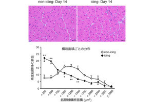 神戸大、肉離れなどの重い筋損傷後のアイシングは筋再生を遅らせる事を確認