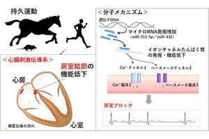 立命館大、アスリートに起きる不整脈「房室ブロック」の原因機構を解明