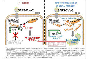 北大、細胞内に侵入した新型コロナウイルスを認識するセンサー遺伝子を発見