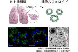 慶大など、新型コロナの感染状態を体外で再現できる肺胞細胞の実験系を開発