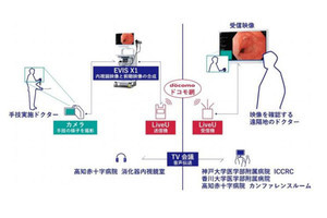 消化器内視鏡映像のリアルタイム伝送実証に成功 ‐ ドコモら5者