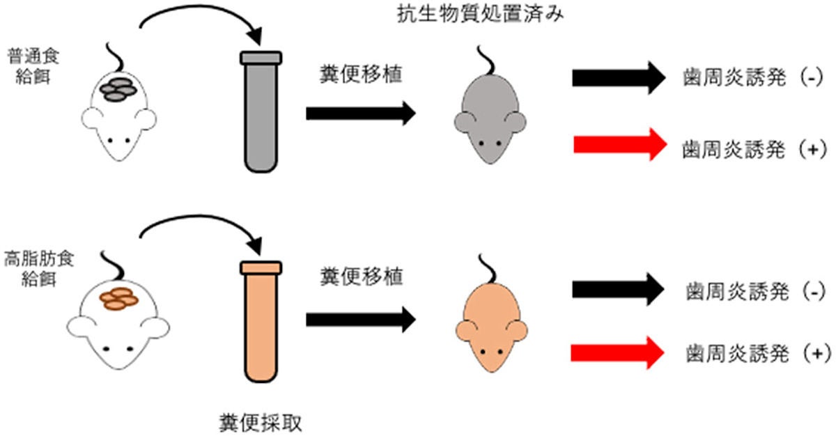 肥満による腸内細菌叢の変化が歯周病を悪化させることを新潟大などが