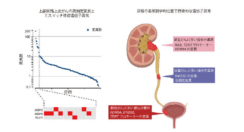 上部尿路上皮がん