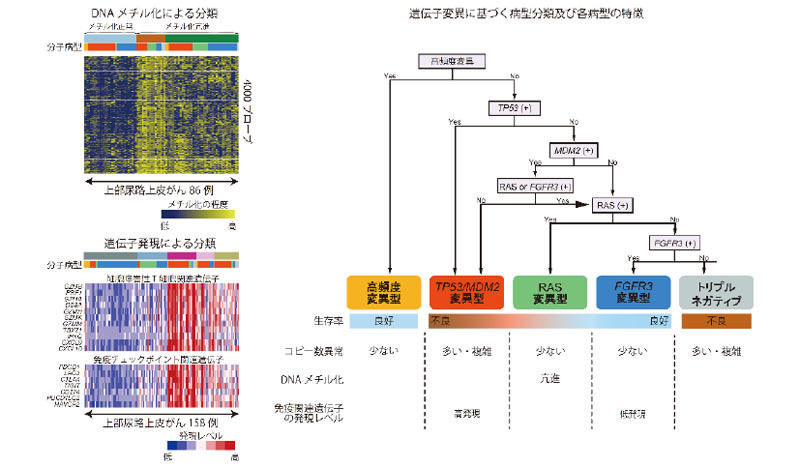 上部尿路上皮がん