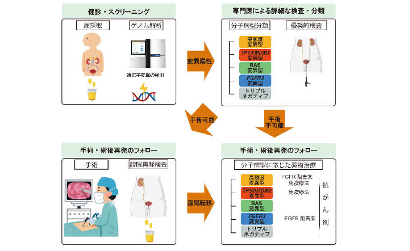 上部尿路上皮がん