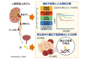 京大など、上部尿路上皮がんの分子分類手法と新規分子診断手法を開発