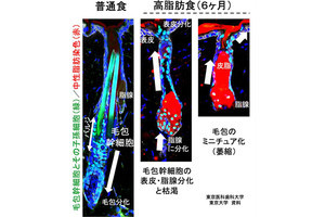 医科歯科大など、中高年以降の肥満は脱毛・薄毛を促進することを確認