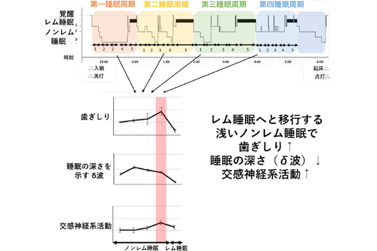 子どもの歯ぎしり