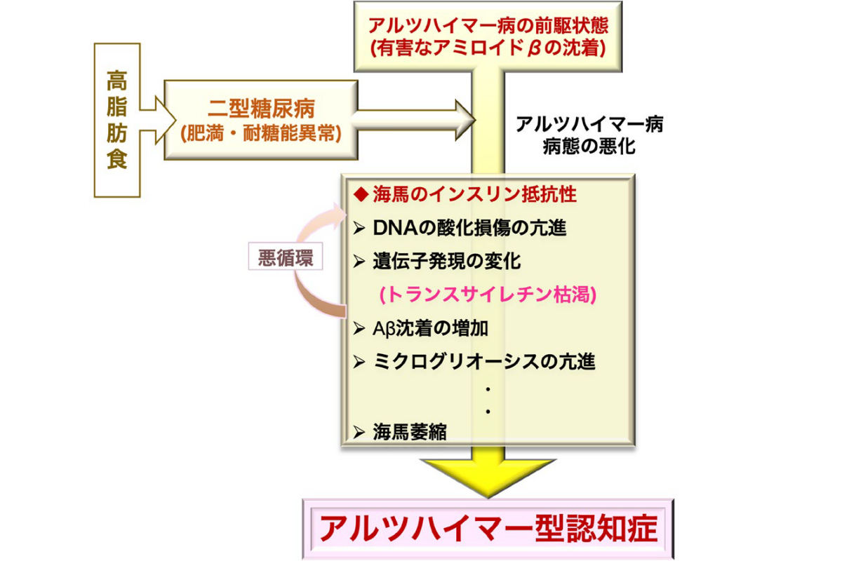 アルツハイマー病