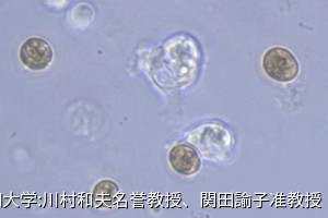 サンゴの培養細胞が褐虫藻を取り込んだ瞬間を観察、白化現象の解明に期待