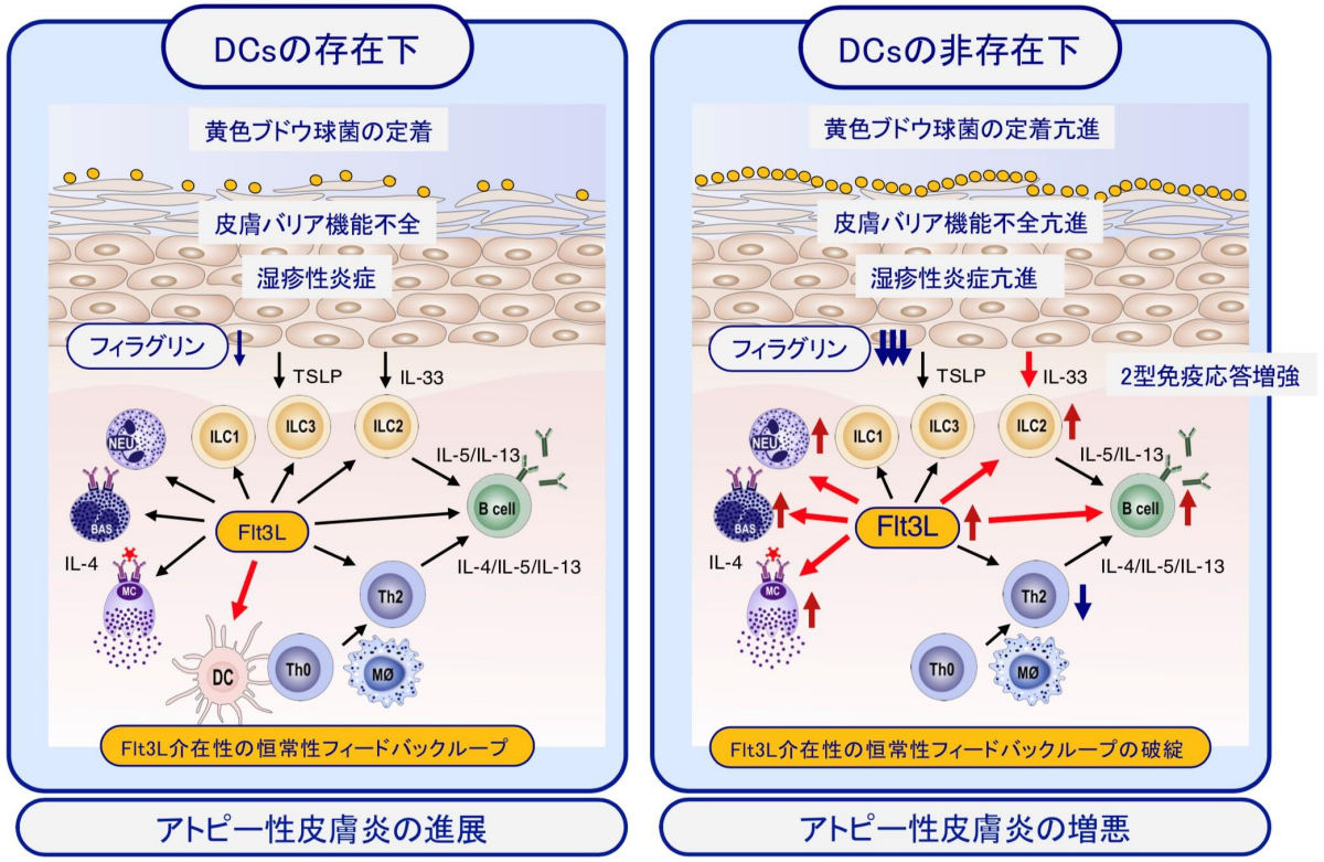 アトピー性皮膚炎