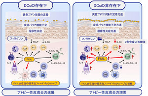 「樹状細胞」がアトピー性皮膚炎の悪化を防ぐ役割であることを宮崎大が確認