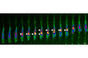 発達障害の要因の1つとなる胎児期の脳神経細胞の移動機構を東薬大が解明